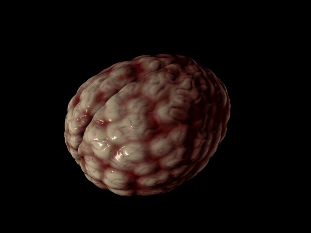 mozek2.jpg
